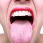 Про які захворювання може розповісти язик?
