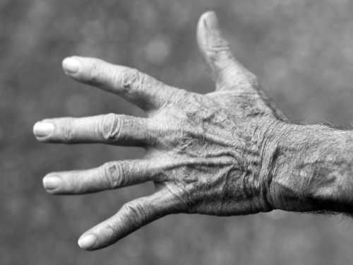 Слабкість м’язів у літніх людей – це саркопенія. Як можна запобігти її трагічним наслідкам?