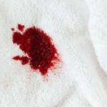 Як вивести плями крові: сучасний гід для дому