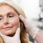 6 пластичних операцій, які покращують якість життя