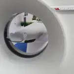 Білоруський лікар-пульмонолог розвінчав популярний міф про туберкульоз: помиляються багато хто