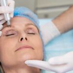 Блефаропластика: повний гід по операції на повіках – показання, методи, відновлення