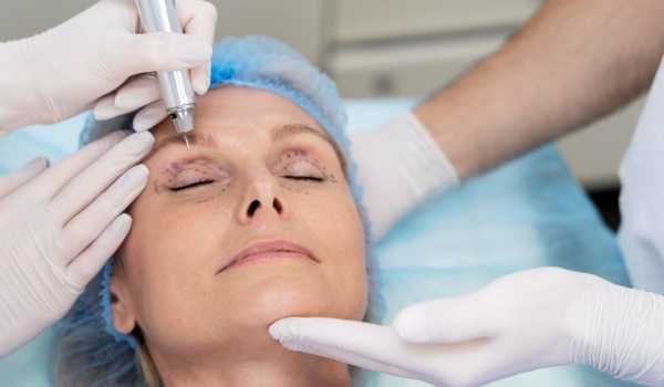 Блефаропластика: повний гід по операції на повіках – показання, методи, відновлення