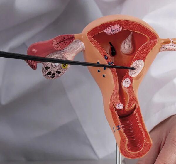 ВООЗ б’є на сполох: 660 тисяч жінок щорічно вражає рак шийки матки&hellip;